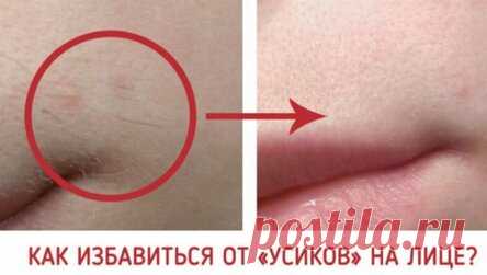 КАК ИЗБАВИТЬСЯ ОТ «УСИКОВ» НА ЛИЦЕ?