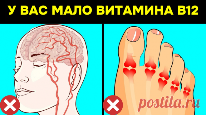 15 критических признаков дефицита витамина В12, которые мы никогда не должны игнорировать | Игорь Ботоговский | Дзен
