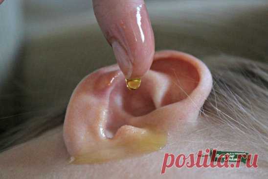 Ушная сера — желтое смолянистое вещество, вырабатывающееся в ушном 
канале, которое выполняет функцию природного антисептика и помогает 
вывести из уха отмерший эпителий. Часть серы выводится наружу в 
результате жевания или зевания, а часть остается. 
Привычка очищать уши ватными палочками чревата утрамбовкой серы, что 
может привести к образованию серной пробки. Также неаккуратным движением 
ты рискуешь повредить барабанную перепонку. 
От чрезмерного скопления серы в ухе может появиться ощущ