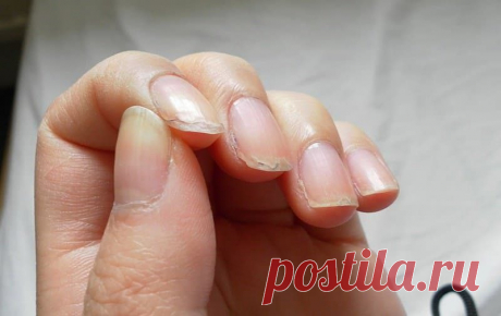 Почему слоятся ногти и появляются судороги?