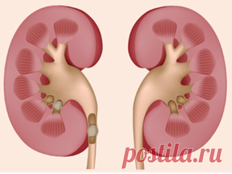 Новости - МирТесен