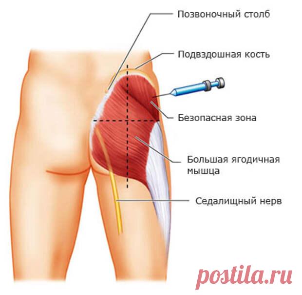 Как правильно делать инъекции? Важная информация! | KaifZona.Ru