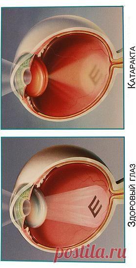 Тест на глаукому и катаракту