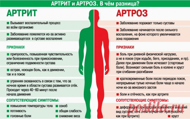 Артрит и артроз. В чем разница