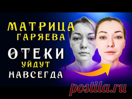 Матрица Гаряева для Очищения Лимфы ☀️ Восстановление Лимфатической Системы ☀️Исцеление Звуком