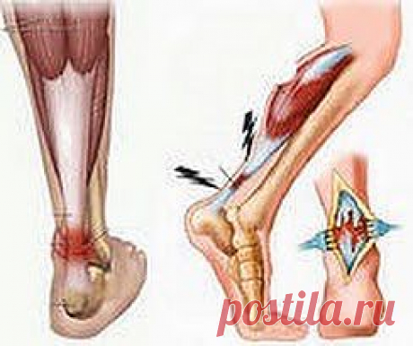 «Лыжную» травму лечит чеснок | Друг пенсионера
Хочу помочь тем людям, которые в жизни, возможно, столкнутся с растяжением связок. Травма эта не тяжелая, но, что непри­ятно, может надолго вывести челове­ка из рабочего состояния, главное, ведь и предсказать-то ее нельзя.