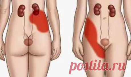 10 признаков больных почек: Обзор