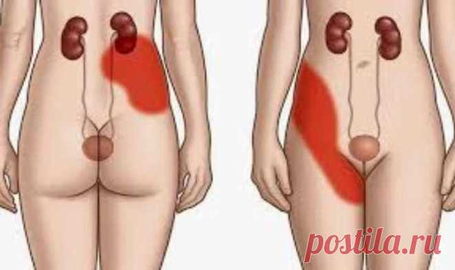 10 признаков больных почек: Обзор