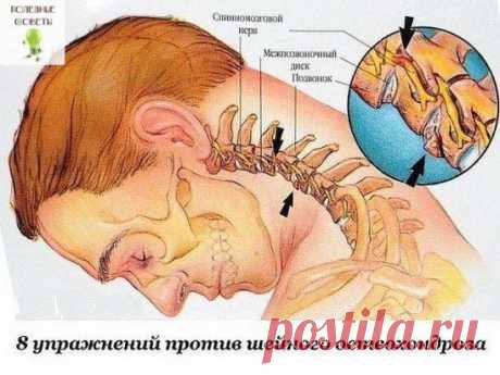 8 упражнений от остеохондроза