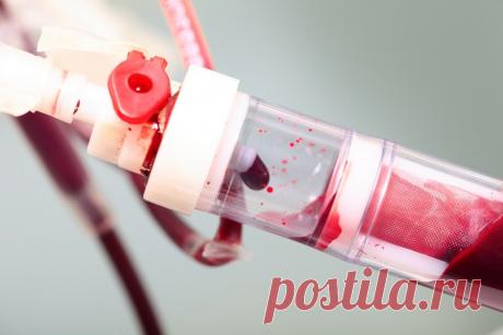 Гемофилия у детей. Гемофилией болеют преимущественно мальчики. В прежние времена считалось, что только мальчики (и соответственно мужчины). В настоящее время медицина располагает более точными эпидемиологическими данными. Кроме того стало известно больше форм гемофилии. Современные врачи не исключают риска гемофилии и у девочек тоже – но в основном это по-прежнему мужской недуг.