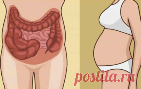 От вздутия живота помогут простые упражнения