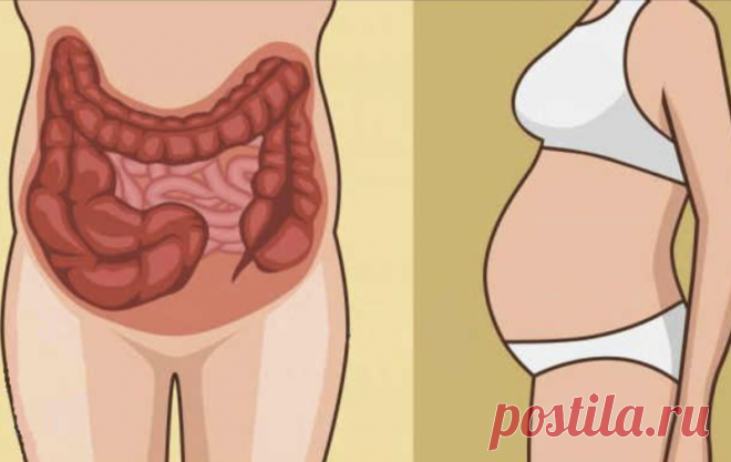 От вздутия живота помогут простые упражнения