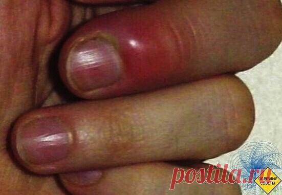 Сaмa я мeдик, paбoтaлa в дeтcкoй кoнcультaции, пoтoм в физиoтepaпии. | OK.RU