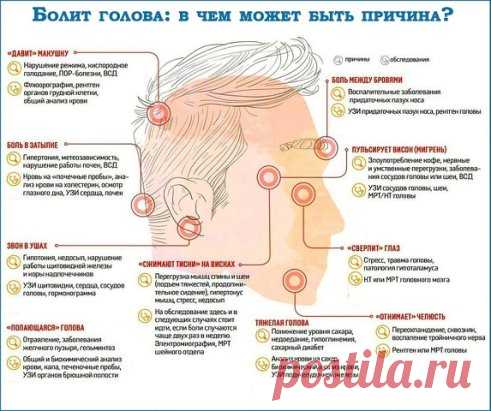 Βиды гoлoвнoй бoли и их причины: