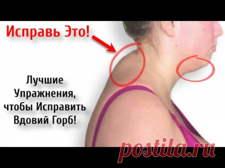 Как избавиться от горба на шее (ХОЛКА) в домашних условиях (БЫСТРО) | Исправь за 30 дней!