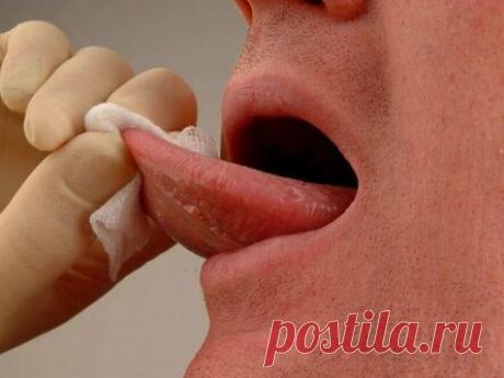 Онкологи перечислили симптомы рака головы и шеи