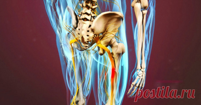 Разблокируй седалищный нерв: делай эти 2 простых упражнения, чтобы избавиться от боли ---