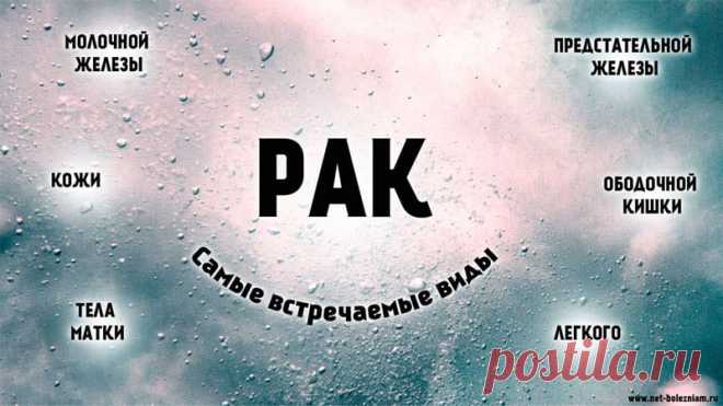 Виды рака: 28 самых встречаемых онкологических заболеваний 

Самыми встречаемыми видами рака являются: рак легкого, рак плевры, рак желудка, рак молочной железы, рак желчного тракта, рак печени, рак поджелудочной железы, рак пищевода, рак прямой кишки, рак щитовидной железы, лейкоз, меланома, лимфома, рак предстательной железы.