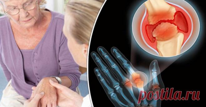 Основы правильного питания при болезнях суставов.