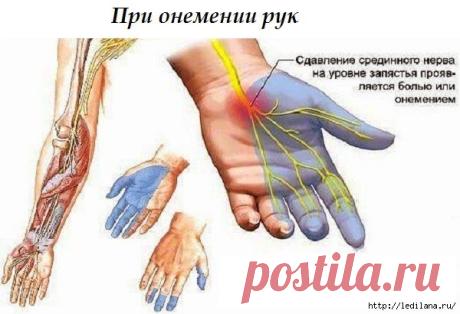 Народные рецепты против онемения рук и ног