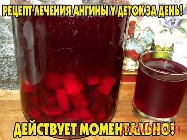 В молодые годы я часто болела ангиной. Но однажды я поехала в командировку в Новосибирск и встретила там народного целителя.

Он был поражен тем, что я так долго болею ангиной. «Ангину нужно лечить не более 24-х часов, — сказал он. — Иначе будет осложнение на сердце». 

Рецепт, который он мне дал, — простой и доступный каждому. 1 корнеплод столовой (красной) свеклы натереть на мелкой терке. На один стакан натертой массы добавить 1 столовую ложку 9% -ного уксуса. Выдержать ...