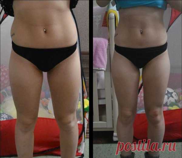ПОДСЛУШАНО У ДИЕТОЛОГА: Используем домашнее средство. Убираем жир на животе - процедуры на 14 дней. | Подслушано у диетолога | Яндекс Дзен