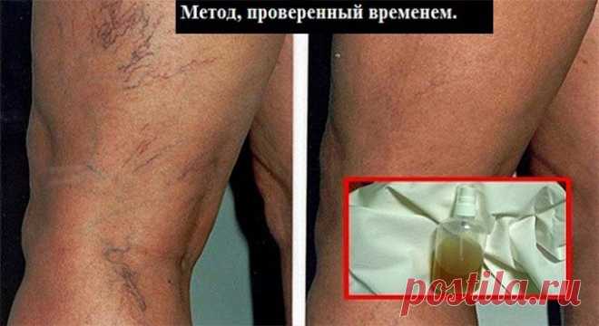 Этот бальзам из натуральных компонентов — лучший способ убрать сосудистую сетку и вернуть коже красоту! — Полезные советы