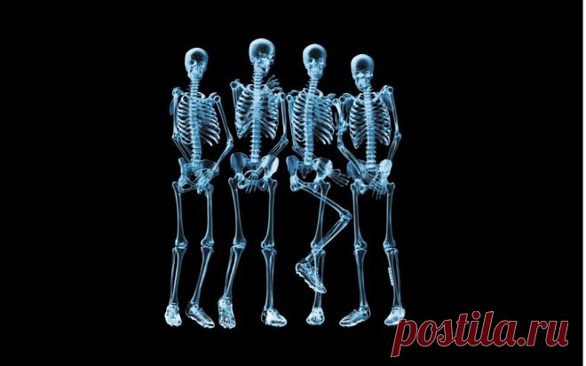 Скилеты, рентген обои для рабочего стола, картинки, фото, 1920x1200.
