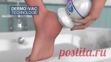 Электрическая пемза Pedi Vac