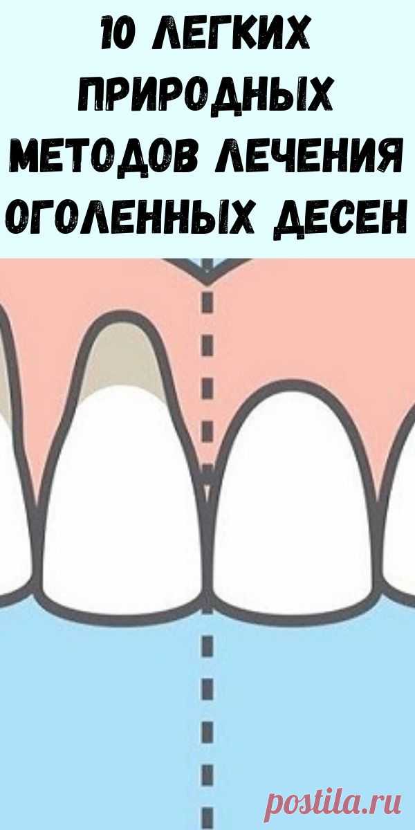 10 легких природных методов лечения оголенных десен - Интересный блог