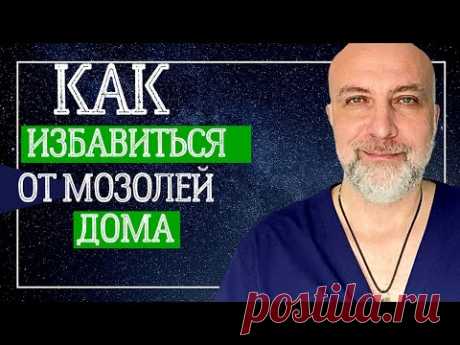 Как избавиться от мозолей | Простой способ Как лечить в домашних условиях