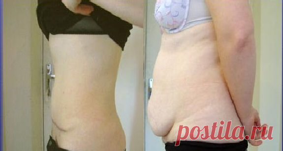 Рецепт приготовления домашнего жиросжигателя, при помощи которого я убрала свисающий живот за 20 дней | Худеем вместе | Яндекс Дзен