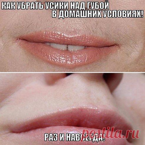 КАК УБРАТЬ УСИКИ НАД ГУБОЙ В ДОМАШНИХ УСЛОВИЯХ! РАЗ И НАВСЕГДА!
Хотите избавиться от темных волос над губами? Нет ничего проще! Этот метод стоит копейки и не надо идти ни в какие салоны! Абсолютно безболезненно и волоски больше не растут. Записывайте рецепт: 
Читать продолжение - ok.ru/ne.svoya
