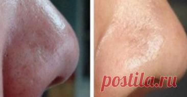 7 способов использования пищевой соды, которые сделают вас более привлекательным и чистым человеком! — Journal women❜s