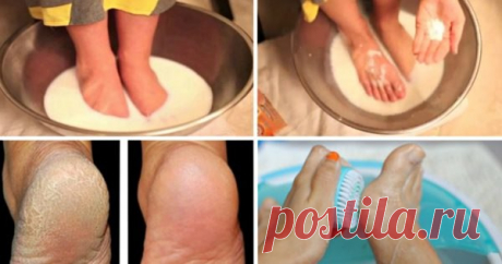 Хватит тратить деньги на педикюр: эти 2 простых продукта сделают твои ножки идеальными! 
КРАСОТА ЛАЙФХАКИ ЛЕТО МОЛОКО НОГИ ПЯТКИ СОДА 
Согласись, огрубевшие и шершавые пятки своим видом могут испортить впечатление даже о самой симпатичной женщине. 

Рецепт средства для пяток, которое в кратчайшие сроки сделает их мягкими и нежными, как у младенца. 
Показать полностью…