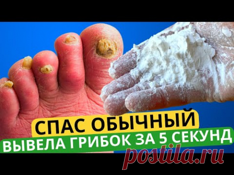 Грибок Ногтей НАВСЕГДА Исчезнет За 5 секунд, Поможет Этот Способ! Лечение Грибка Ногтей ЛЕГКО!