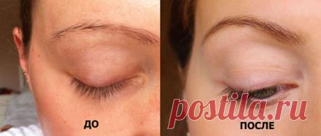 Применение касторового масла для здоровья и красоты — Домашние заботы