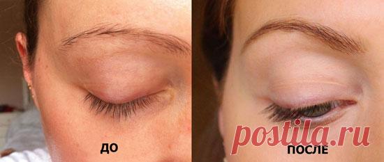 Применение касторового масла для здоровья и красоты — Домашние заботы