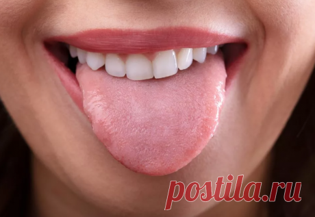 О чём расскажет язык: как состояние органа отражает здоровье всего организма На первый взгляд язык кажется простым органом, но именно он способен первым сигнализировать о неполадках в организме. Даже когда серьёзные болезни ещё не проявились другими симптомами, язык уже может...