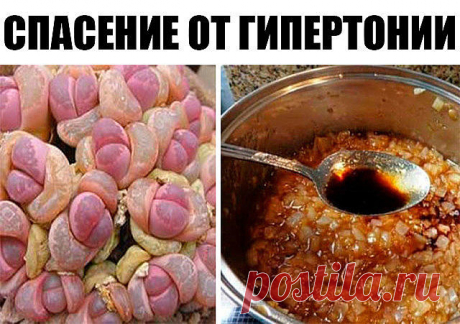 У кого ГИПЕРТОНИЯ, срочно читать! Давление 120/80 будет ВСЕГДА…

Здравствуйте дорогие читатели! Спешу рассказать об одном безотказном средстве, которое уже не первый год помогает мне снимать приступы гипертонии.

Итак, берем кастрюльку, наливаем в нее 1 литр воды и кладем пол килограмма сахарного песка. После того, как вода закипит, и сахар в ней полностью растворится, следует взять 5 штучек синих луковиц и разрезать каждую на 4 части, опустить их вместе с шелухой в сладки...