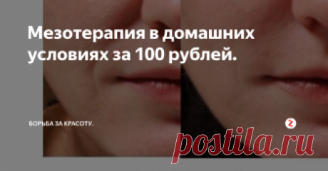 Мезотерапия в домашних условиях за 100 рублей. Можно делать процедуры дома самостоятельно, тратя буквально копейки.
Для самостоятельного проведения давно придумали различные приспособления. Я уже много лет пользуюсь мезороллером.
Вот он.