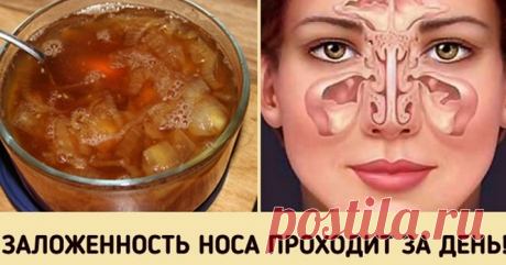 Быстро и просто избавиться от заложенного носа вам поможет этот луковый сироп! - Образованная Сова Естественный метод борьбы с заложенностью носа, насморком, а также синуситом! Стоит попробовать! Многие называют это средство насосом, потому что оно может помочь быстро удалить скопление слизи при простуде, гриппе, а также синусите. Заложенность носа – это один из самых раздражающих симптомов респираторных заболеваний. К счастью, есть естественные способы, с помощью которых ...