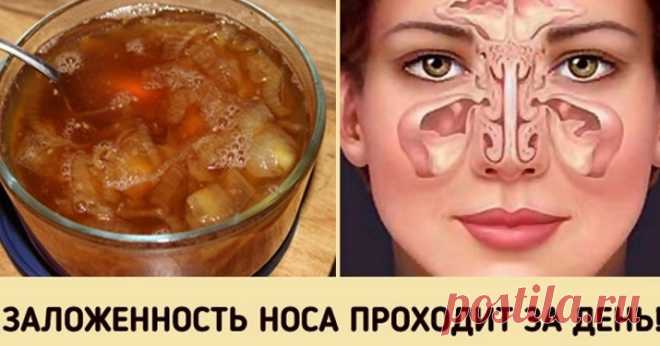Быстро и просто избавиться от заложенного носа вам поможет этот луковый сироп! - Образованная Сова Естественный метод борьбы с заложенностью носа, насморком, а также синуситом! Стоит попробовать! Многие называют это средство насосом, потому что оно может помочь быстро удалить скопление слизи при простуде, гриппе, а также синусите. Заложенность носа – это один из самых раздражающих симптомов респираторных заболеваний. К счастью, есть естественные способы, с помощью которых ...