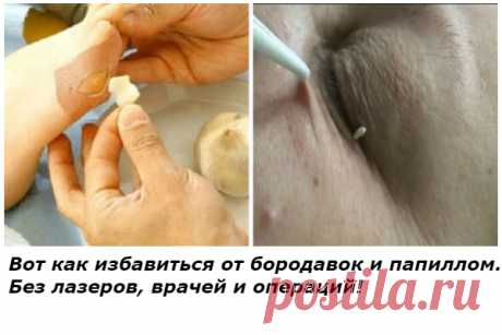 ЦЕННЕЙШАЯ ПРАКТИКА ИЗ ДАОСА — «КОЛЕННАЯ» ХОДЬБА ВЫЛЕЧИТ ПОЧКИ И ПОМОЖЕТ ПОХУДЕТЬ — Копилочка полезных советов