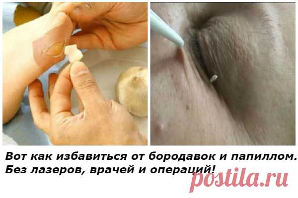 ЦЕННЕЙШАЯ ПРАКТИКА ИЗ ДАОСА — «КОЛЕННАЯ» ХОДЬБА ВЫЛЕЧИТ ПОЧКИ И ПОМОЖЕТ ПОХУДЕТЬ — Копилочка полезных советов