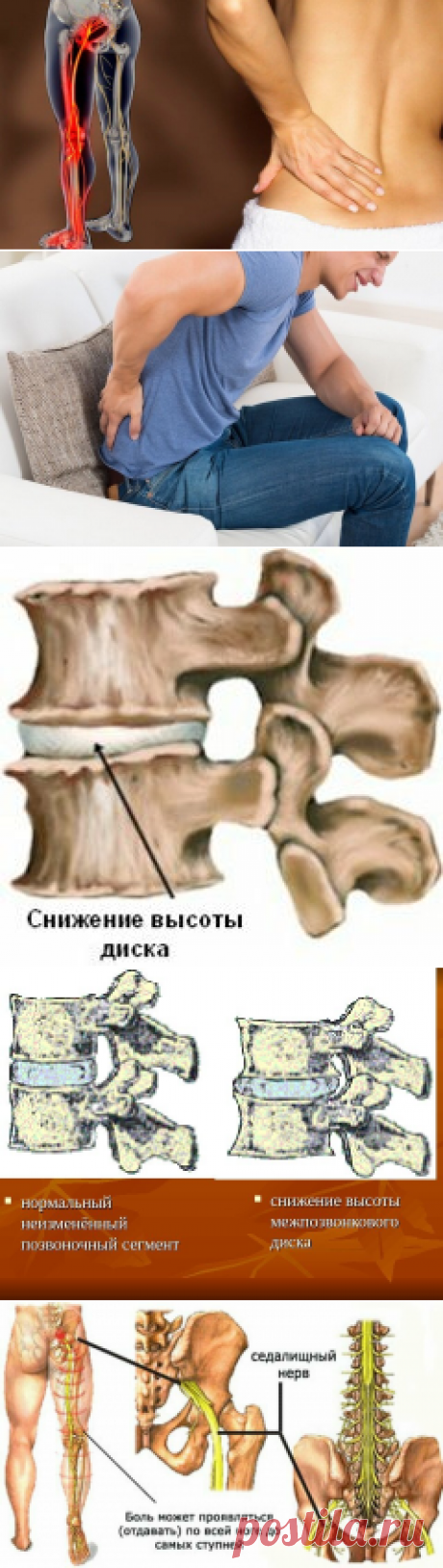 КАК УБРАТЬ БОЛЬ В ПОЯСНИЦЕ,КРЕСТЦЕ И НОГАХ? | Здоровый образ жизни. | Яндекс Дзен