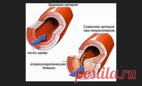 «Лечение сахарного диабета Лечение сахарного диабета различных типов: средства и методы. Данная болезнь способна вызвать серьезные осложнения, например, сосудистые заболевания и поражения мозга. Поэтому важно на начальном этапе проводить грамотное лечение диабета. В международной практике применяется несколько уровней управления сахарным диабетом 2-го типа: низкоуглеводная диета, комплексы физических упражнений, прием лекарственных препаратов и гор...