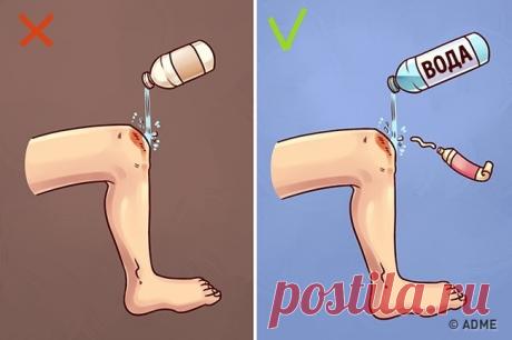 10 известных приемов первой помощи, которые 90 % людей делают неправильно