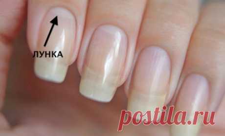 Вот почему могут исчезнуть белые лунки у основания ногтя: не пропусти тревожный симптом! — Народная Воля