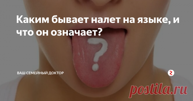 Каким бывает налет на языке, и что он означает? Существует выражение о том, что глаза – зеркало души. Язык же является тем «зеркалом», в котором отражаются различные неполадки, происходящие в организме.
Язык – это орган, который реагирует на возникшие патологические процессы изменением цвета и образованием налета. При этом проявления на языке могут возникнуть уже тогда, когда других очевидных признаков болезни человек еще не замечает.